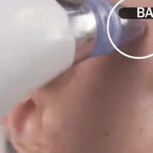 Deep Clean Pore Suction Device
